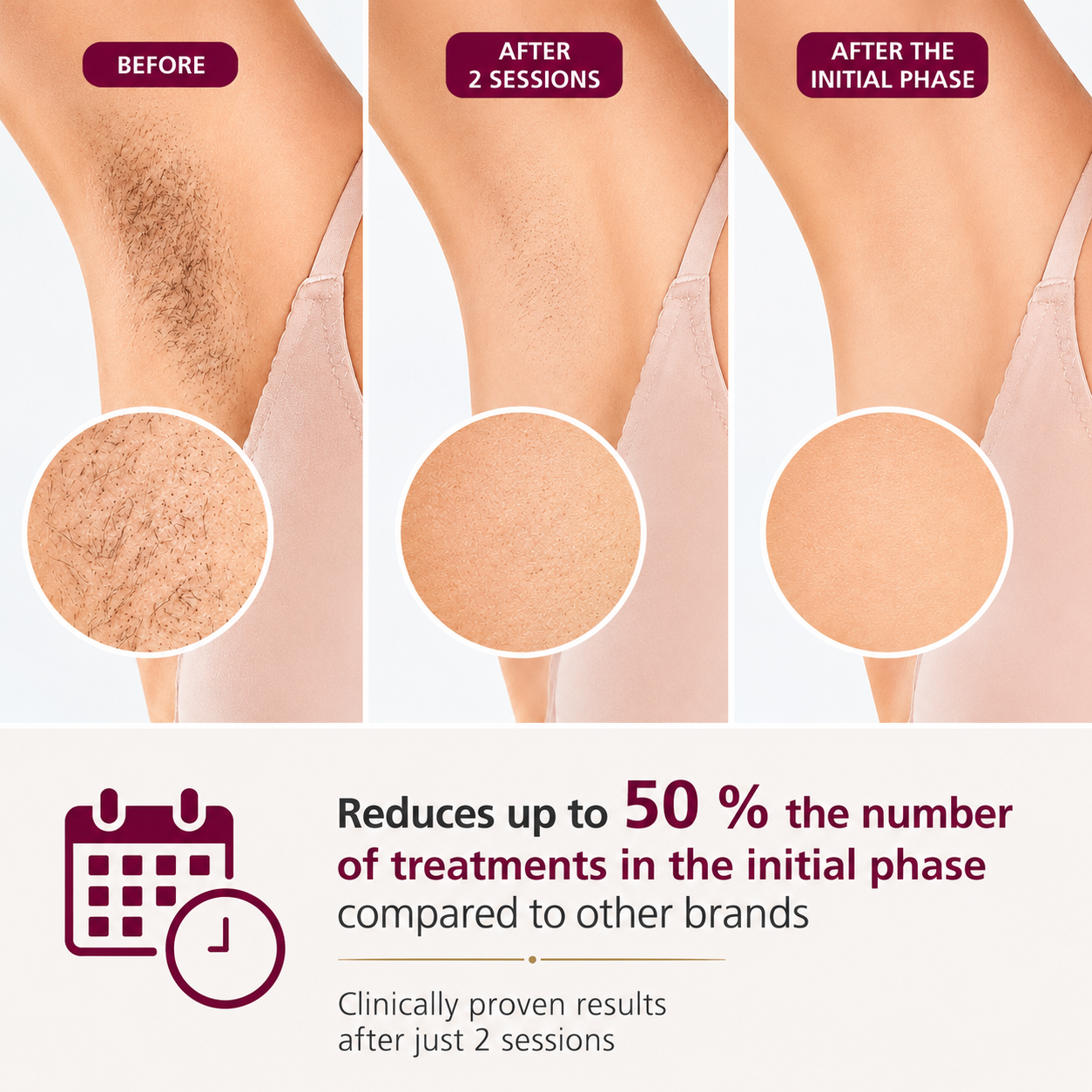 Philips Lumea 9900 Series IPL Hair Removal Device | SenseIQ™ & SkinAI™ Technology